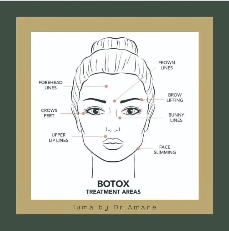 Wrinkle relaxant treatment planning at luma