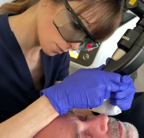 Close-up of Sydney guiding the laser handpiece around a patient’s eye during COOL BLEPH treatment