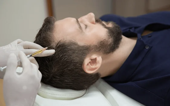 PRP and PRF treatment preparation at luma